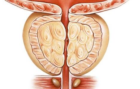 男性發(fā)生膀胱炎怎么辦  有哪些治療方法