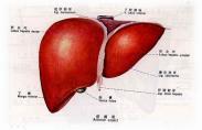 膽汁性肝硬化 膽汁性肝硬化