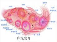 卵巢纖維組織來源腫瘤